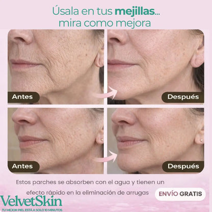 VelvetSkin® - Piel más tersa, fresca y radiante desde la primera vez