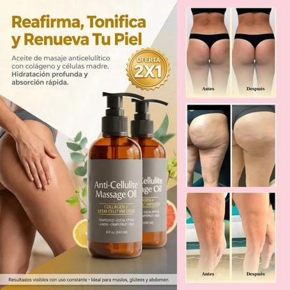 CelluLift® - Piel más firme desde la primera semana