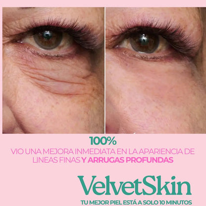 VelvetSkin® - Piel más tersa, fresca y radiante desde la primera vez