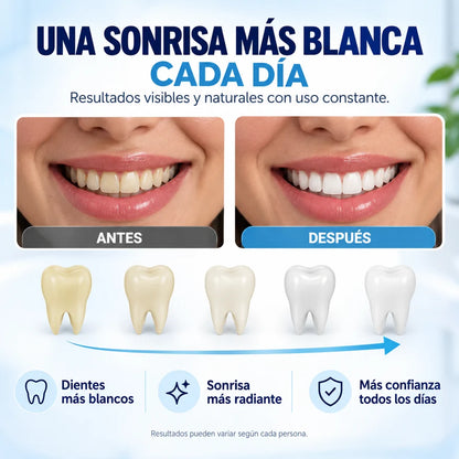 WhiteDent - Mejora la apariencia de tu sonrisa